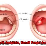 Fakta Menarik Amigdala, Kenali Fungsi dan Gangguan